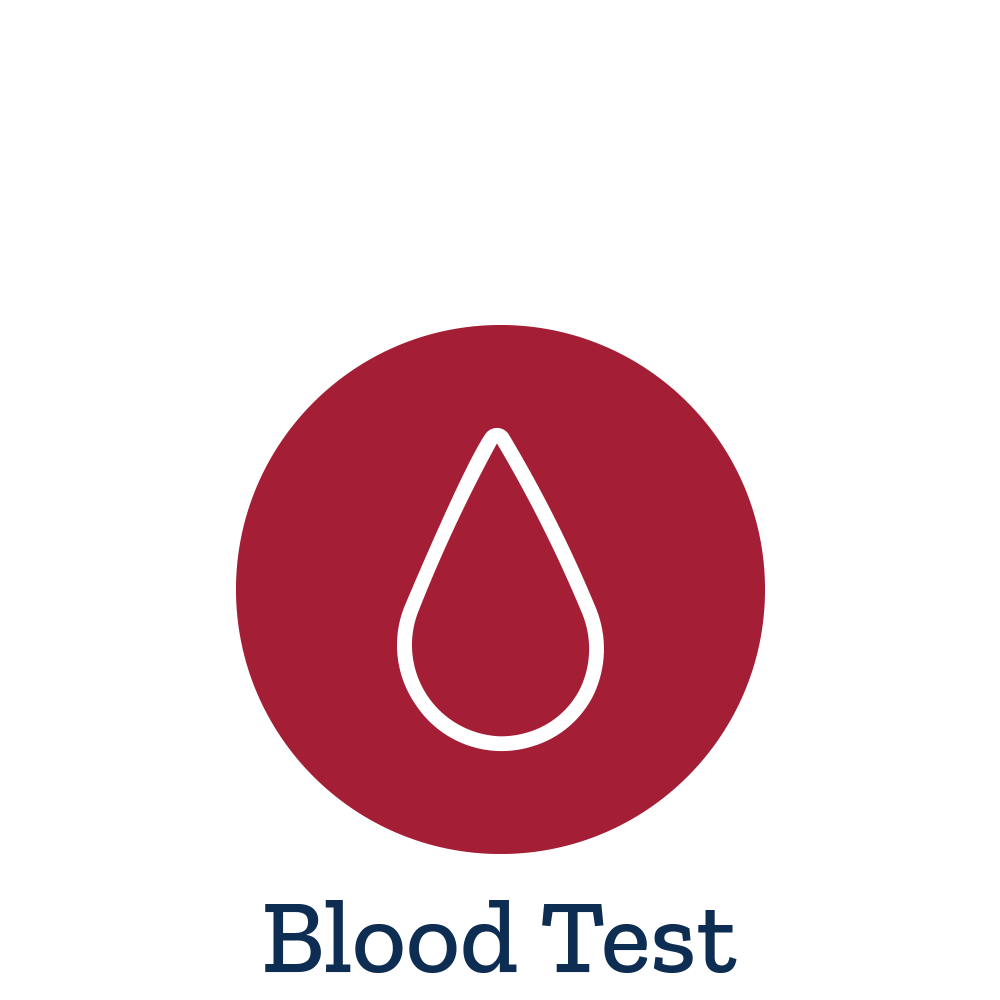 Oxidized LDL Blood Test - Life Extension