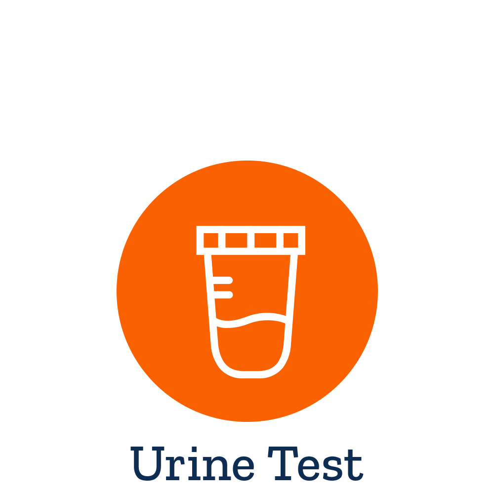 F2-Isoprostanes (F2-IsoPs) Urine Test - Life Extension